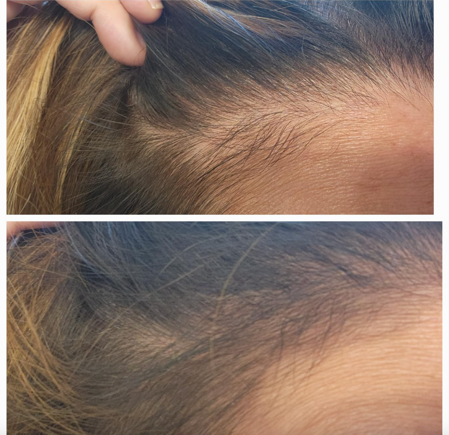 Flxhair Saç tozu