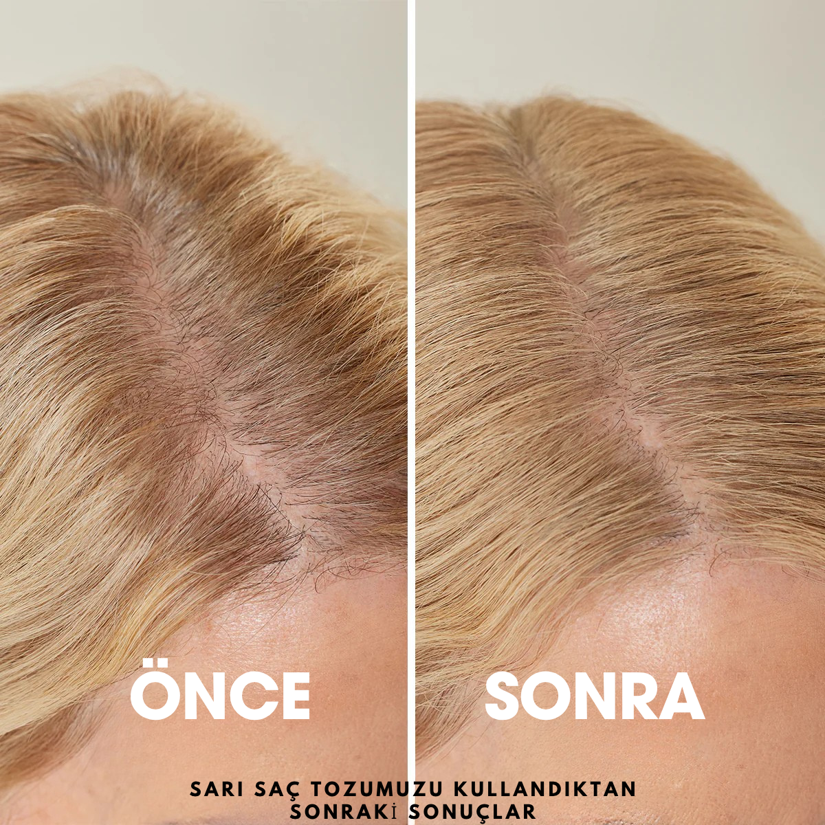 Flxhair Saç tozu