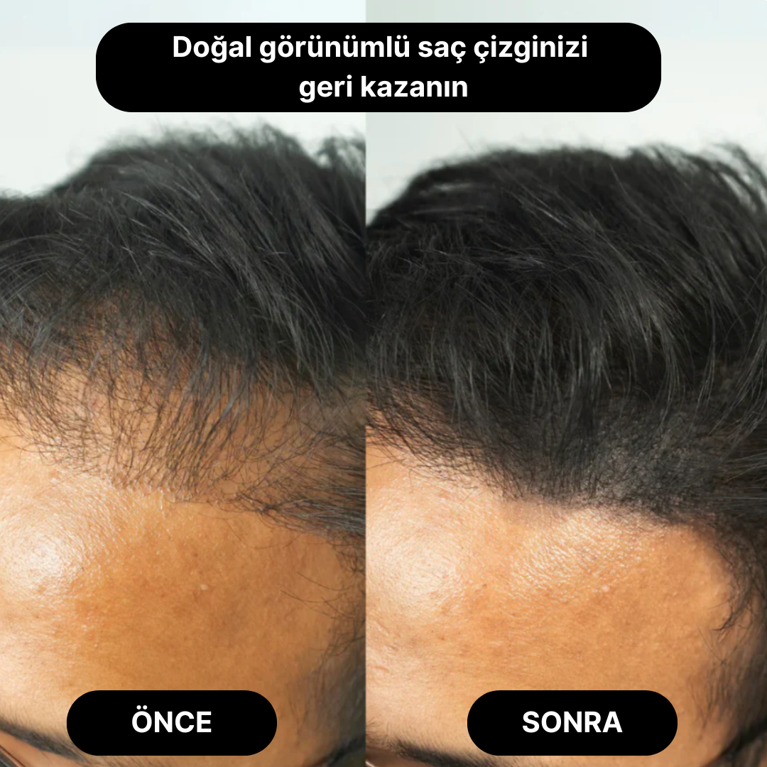 Flxhair Saç tozu